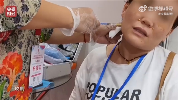 央視315曝光不可注射的美容針：10倍利潤 或致毀容